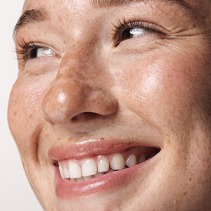 Anti-Acne Moisturizing Cream
